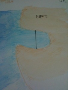 What the city would look like without the city part.